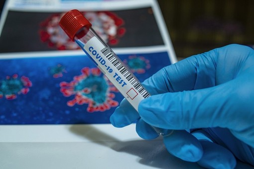 Coronavirus, lieve calo dei ricoveri su base regionale ma il tasso di positività cresce al 13,69% Coronavirus, lieve calo dei ricoveri su base regionale ma il tasso di positività cresce al 13,69%