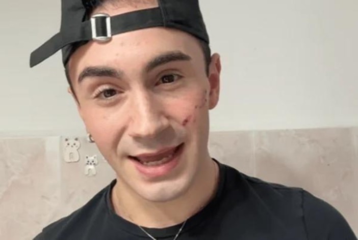 Aggressione omofoba a Genova, il racconto di Domenico Cerqua: “Le parole fanno più male delle ferite” Aggressione omofoba a Genova, il racconto di Domenico Cerqua: “Le parole fanno più male delle ferite”