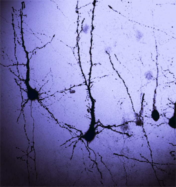 L'IIT verso la sperimentazione di un nuovo farmaco per la cura di disturbi neurologici tipici delle malattie del neurosviluppo