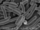 E. Coli Bacteria - Credit: NIAID