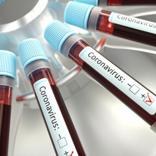 Coronavirus: tasso di positività al nuovo minimo storico (2,7%), calo dei positivi e dei ricoverati