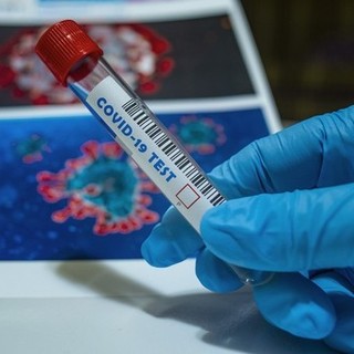 Coronavirus, lieve calo dei ricoveri su base regionale ma il tasso di positività cresce al 13,69% Coronavirus, lieve calo dei ricoveri su base regionale ma il tasso di positività cresce al 13,69%