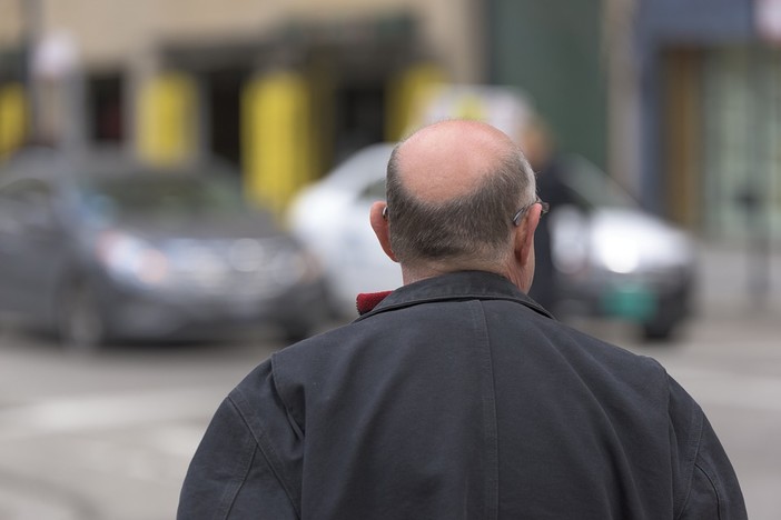 Calvizie e alopecia: dai laboratori di Genova una risposta alla longevità dei capelli Calvizie e alopecia: dai laboratori di Genova una risposta alla longevità dei capelli