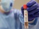 Coronavirus, tasso di positività stazionario e meno tamponi oggi, crescono ricoveri e terapie intensive