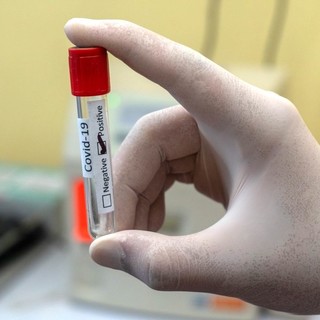 Coronavirus, in Liguria 2.221 i nuovi positivi nelle ultime 24 ore