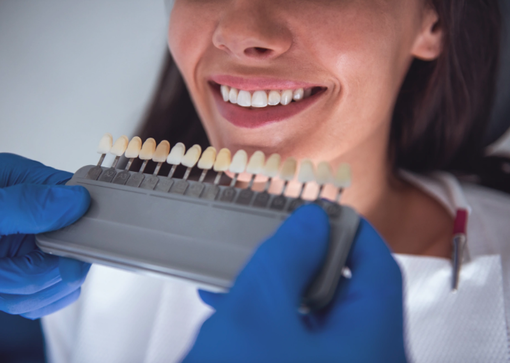 Dentista in Albania: da Genova a Tirana per impianti e faccette, il fenomeno cresce Dentista in Albania: da Genova a Tirana per impianti e faccette, il fenomeno cresce