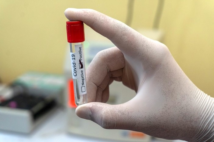 Coronavirus, in Liguria 599 nuovi positivi nelle ultime 24 ore
