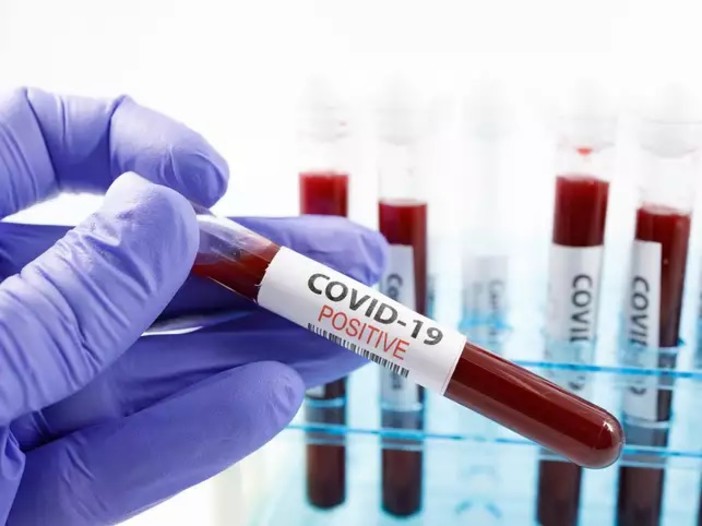Coronavirus: numeri in lieve aumento in tutta la Regione Coronavirus: numeri in lieve aumento in tutta la Regione