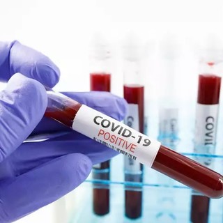 Coronavirus: numeri in lieve aumento in tutta la Regione Coronavirus: numeri in lieve aumento in tutta la Regione