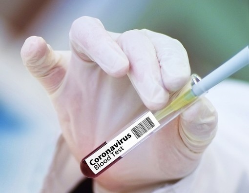 Vaccino anti Covid da gennaio: sarà gratuito e non obbligatorio
