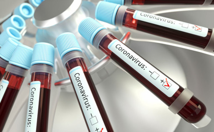 Coronavirus: sono 161 i nuovi positivi in Liguria, 53 nel genovese