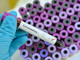 Coronavirus: da ieri 1.102 nuovi casi in Liguria su 6.922 tamponi effettuati