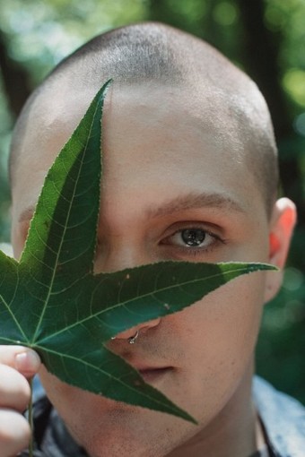 Hai delle chiazze in testa dove non crescono più capelli? Potresti soffrire di alopecia areata