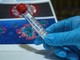 Coronavirus, lieve calo dei ricoveri su base regionale ma il tasso di positività cresce al 13,69% Coronavirus, lieve calo dei ricoveri su base regionale ma il tasso di positività cresce al 13,69%