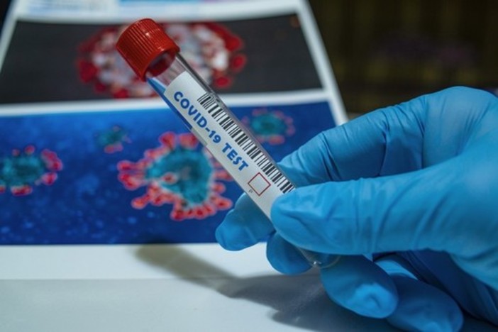 Coronavirus, lieve calo dei ricoveri su base regionale ma il tasso di positività cresce al 13,69%