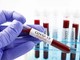 Coronavirus: numeri in lieve aumento in tutta la Regione Coronavirus: numeri in lieve aumento in tutta la Regione