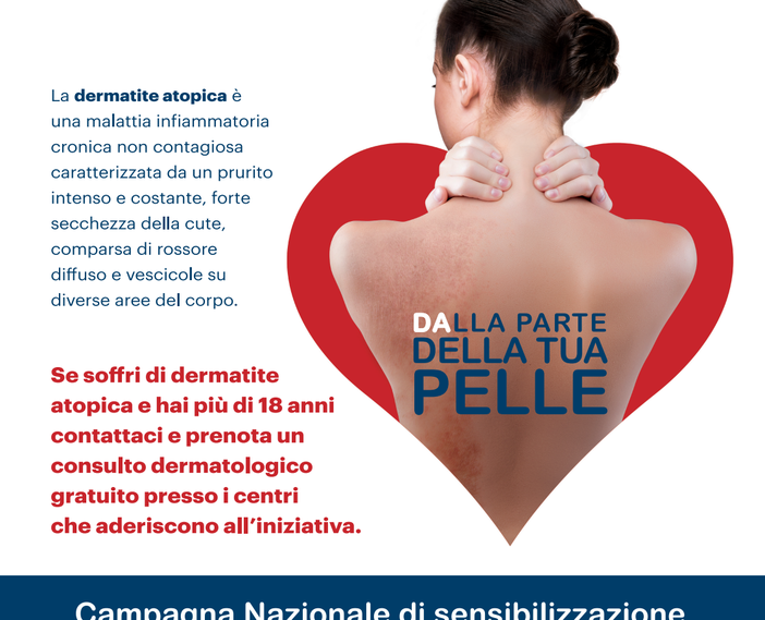 Visite dermatologiche gratuite per chi soffre di Dermatite Atopica domenica 26 settembre al Policlinico San Martino