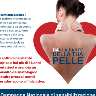 Visite dermatologiche gratuite per chi soffre di Dermatite Atopica domenica 26 settembre al Policlinico San Martino