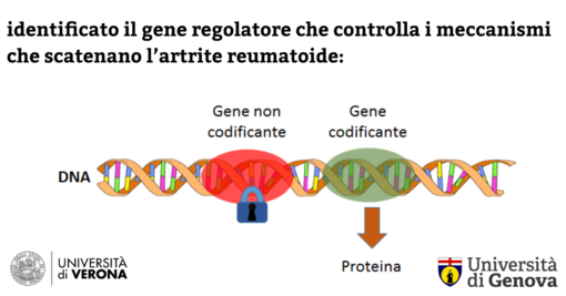 Identificato il gene regolatore che controlla i meccanismi che scatenano l’artrite reumatoide
