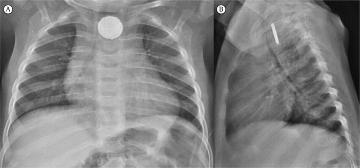 Foto tratta dal sito 'Nurse Times'