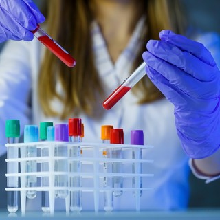 Il 28 febbraio si celebra la Giornata Mondiale delle Malattie Rare