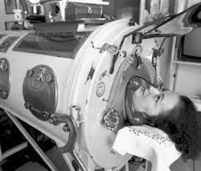 Una scultura al San Martino in memoria di Rossana Benzi, la proposta in consiglio comunale