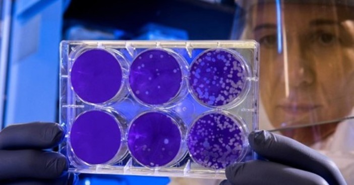 Forse una buona notizia dalla Francia nella lotta al Coronavirus Forse una buona notizia dalla Francia nella lotta al Coronavirus