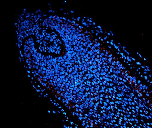 Immagine di un follico di capello umano Immagine di un follico di capello umano