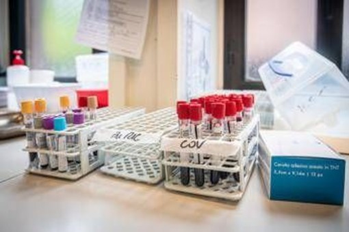 Medicina di laboratorio, 'un semplice esame per scoprire in anticipo le patologie'