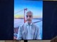 Merlo (Sic): "Per amiloidosi cardiaca servono registri e percorsi condivisi"