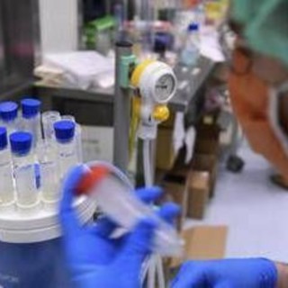 Mieloma multiplo recidivante, Ue approva nuove combinazioni belantamab mafodotin Mieloma multiplo recidivante, Ue approva nuove combinazioni belantamab mafodotin