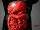 Malattie infiammatorie intestinali, rimborsabile guselkumab per colite ulcerosa e Crohn