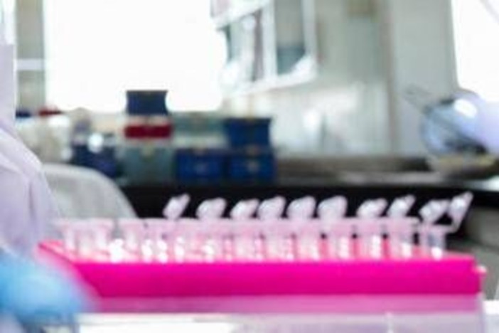 Staminali contro il Parkinson, in Giappone via libera al primo trattamento