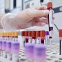 Hiv, dalla Sicilia il modello per estendere terapie long acting