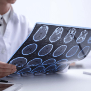 Sclerosi multipla e maternità, neurologa Marfia: "Personalizzare percorso" Sclerosi multipla e maternità, neurologa Marfia: "Personalizzare percorso"