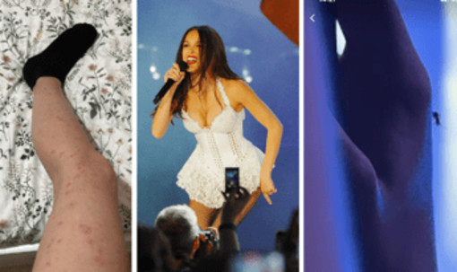 L'Ippodromo delle... zanzare: le critiche a San Siro e la difesa degli organizzatori L'Ippodromo delle... zanzare: le critiche a San Siro e la difesa degli organizzatori