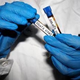 Hantavirus, Ema monitora diffusione: "Pronti a supportare iter vaccini" Hantavirus, Ema monitora diffusione: "Pronti a supportare iter vaccini"