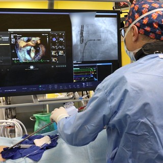 Heart Valve Center del San Raffaele di Milano, 5 anni di innovazione