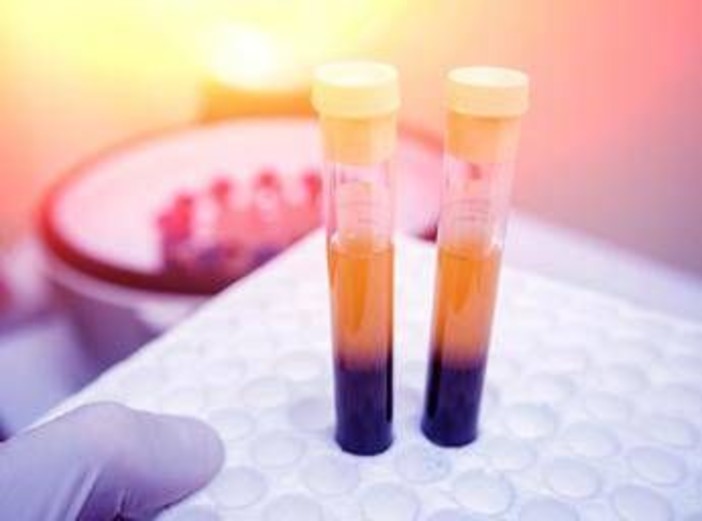 Farmaci, Sava (Sif Magazine): &quot;In plasmaderivati attenzione particolare a sicurezza&quot;