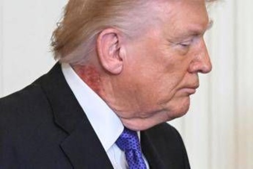 Trump e il collo arrossato, la foto riaccende i dubbi sulla salute del presidente Trump e il collo arrossato, la foto riaccende i dubbi sulla salute del presidente