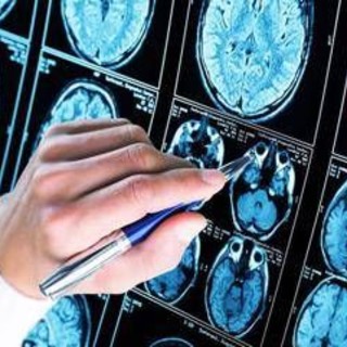 Farmaci, ok Ema a donanemab, neurologi: "Svolta in lotta all'Alzheimer" Farmaci, ok Ema a donanemab, neurologi: "Svolta in lotta all'Alzheimer"