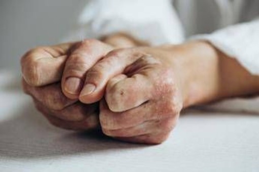 Lo studio, inibitore Il-23 riduce segni e sintomi artrite psoriasica attiva Lo studio, inibitore Il-23 riduce segni e sintomi artrite psoriasica attiva